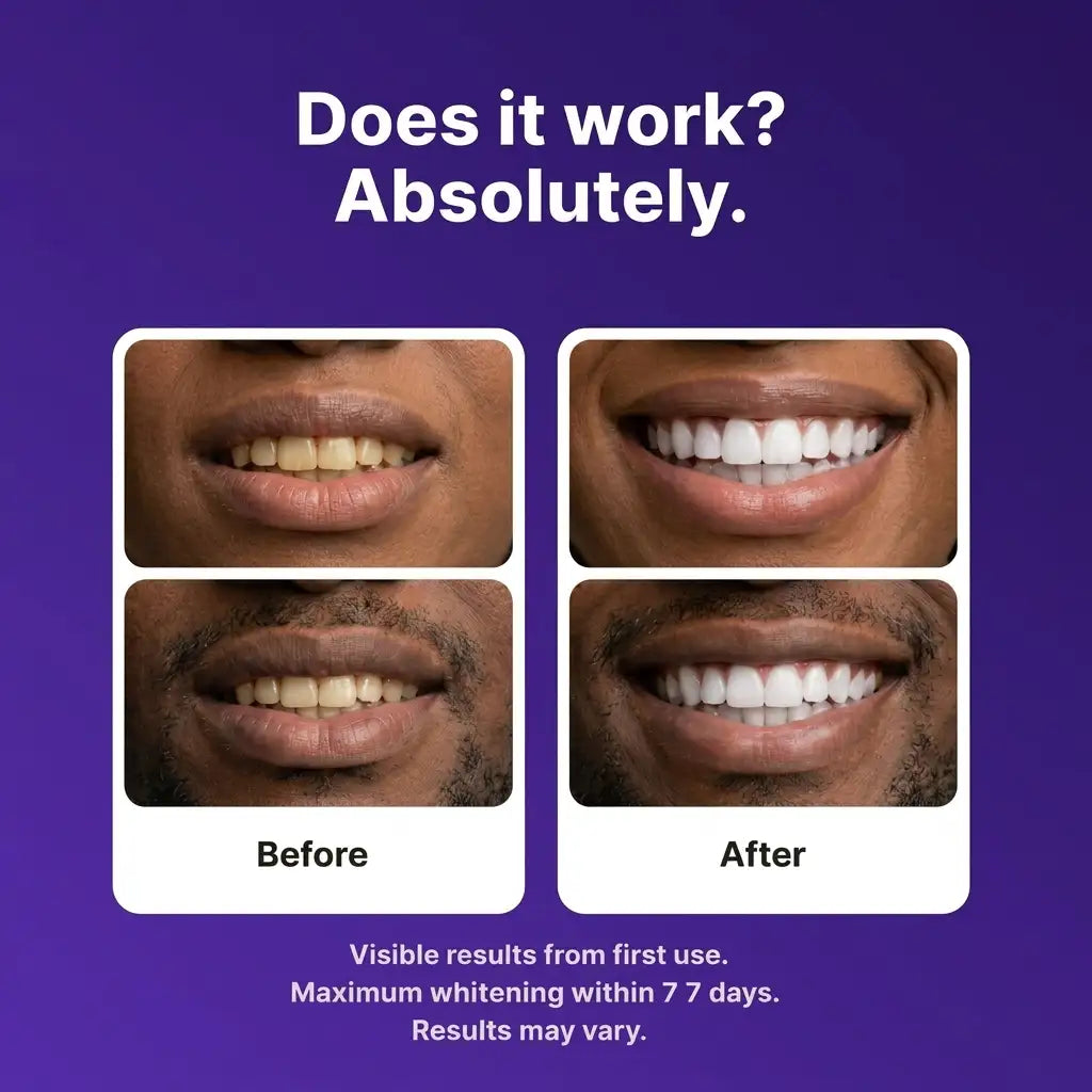 DR.DENT™ Purple Whitening Strips